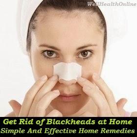 Tips for Getting Rid of Blackheads at Home