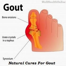 Natural Cures For Gout