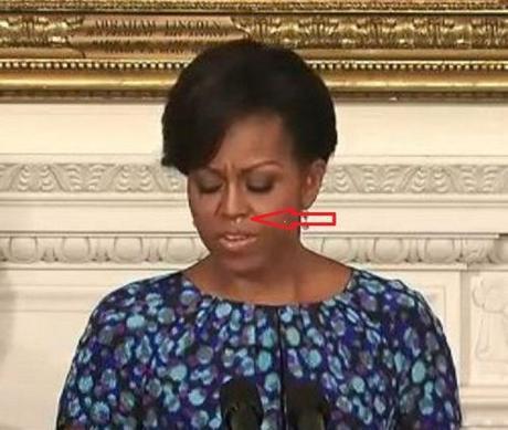 First Lady of Snot