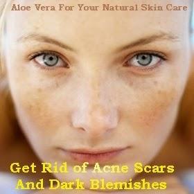 Get Rid of Acne Scars and Dark Blemishes
