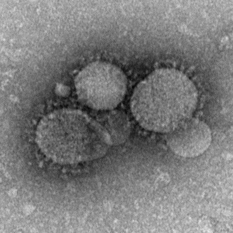 MERS-CoV particles as seen by negative stain electron microscopy. Virions contain characteristic club-like projections emanating from the viral membrane. (CDC PHIL)