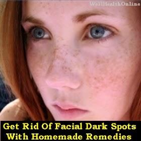 Remove Facial Dark Spots
