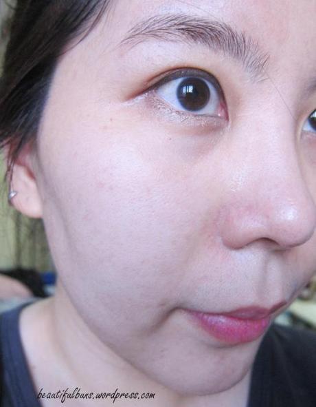 Review: Optimal Pulse Technology OPT by Lumenis OPT 6