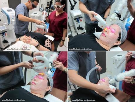 Review: Optimal Pulse Technology OPT by Lumenis OPT 3