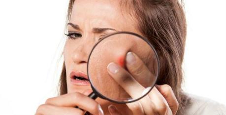 Washing Face Too Much Can Cause Acne