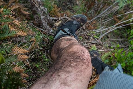 mud on leg after falling wilsons promontory 