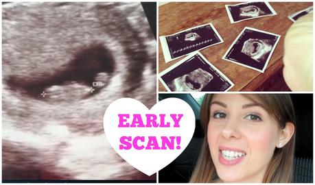 Our early scan!
