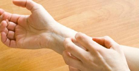 Home Remedies for Eczema Scars Home Remedies for Eczema Scars