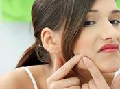 Clear Your Acne with Dandruff Shampoo