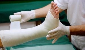 Broken Foot